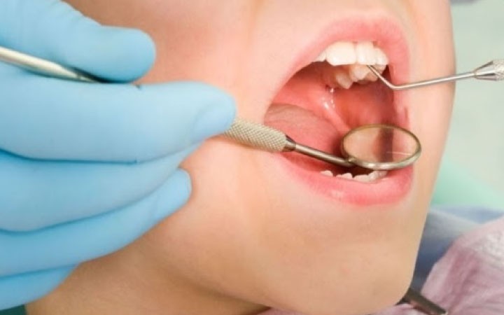 Come-far-accettare-il-dentista